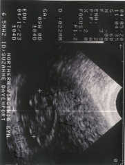 sonogram1-2