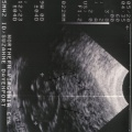 sonogram1-2